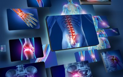 Solutions for managing sciatica in Hot Springs, AR that locals trust for lasting comfort