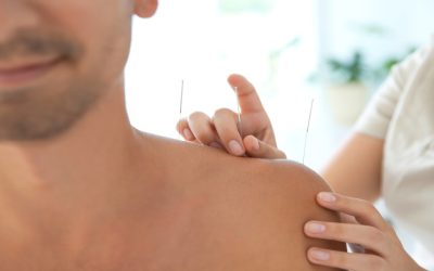 Experience Lasting Relief By Choosing Acupuncture For Pain Management, Berkeley, CA, Solutions